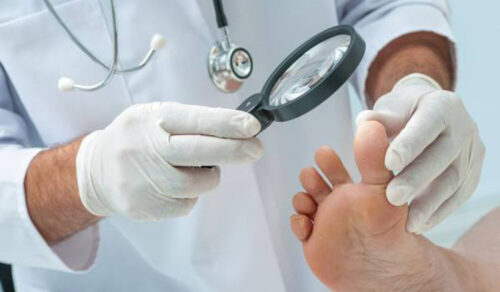 مراقبت از پا در بیماران مبتلا به دیابت
